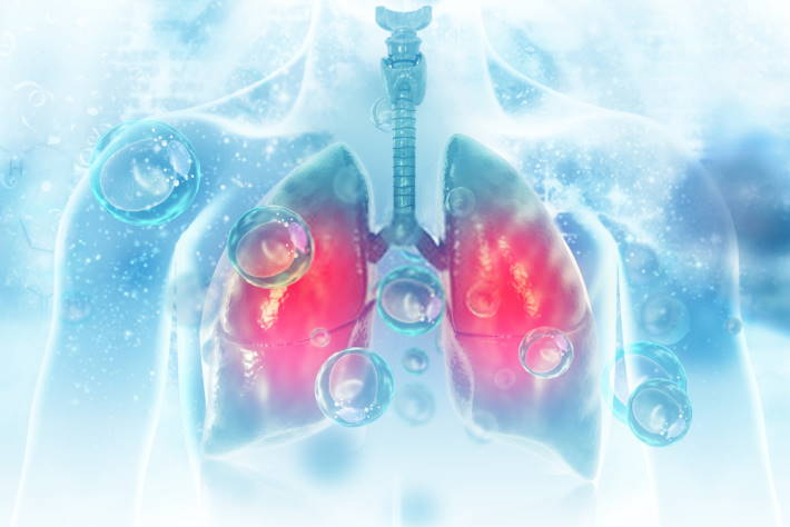 remedios caseros para los pulmones inflamados